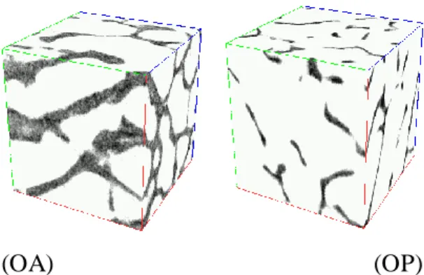 Figure 11. Two 64 3   voxels extracts  from Osteoarthritis (OA) and Osteoporotic (OP) samples to  illustrate the micro architectural differences in the two trabecular bones