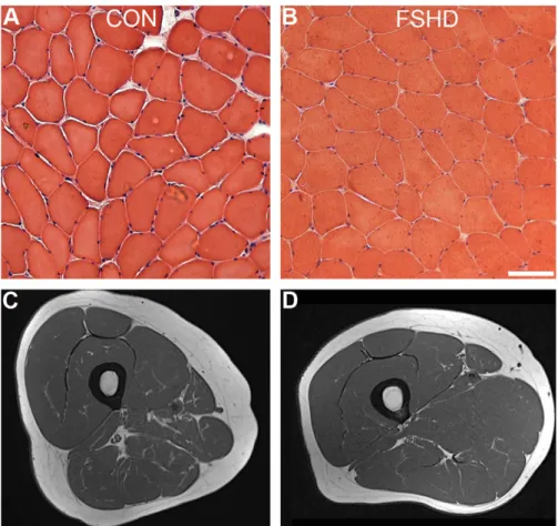 Fig. 5. Histologic and MRI analysis in quadriceps muscle biopsies from patients with FSHD and controls (CON)