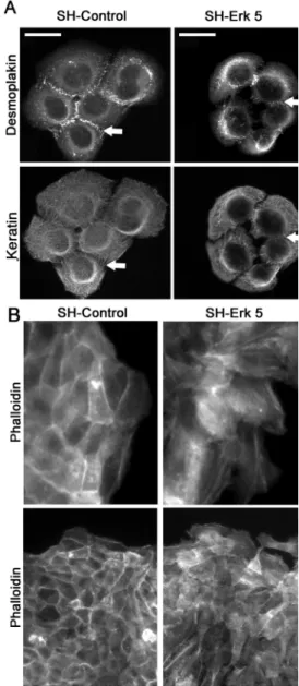 Figure 9. Erk5 knockdown in HaCaT cells induces a destabiliza- destabiliza-tion of keratin and actin cytoskeleton