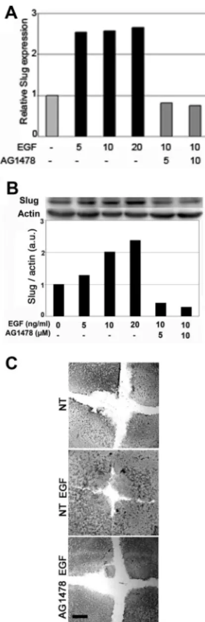 Table 1. Mice skin explants from WT or Slug-deficient mice ( ⫺ / ⫺ )