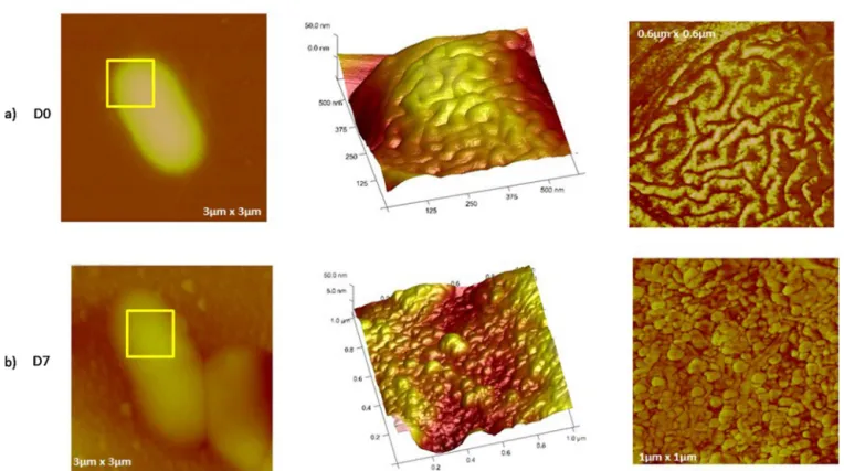 Fig. 8. Comparison of bacteria imaged by AFM in tapping mode on (a) D0 and (b) D7: Zooms reveal the re-organization of LPS molecules of the outer membrane of E