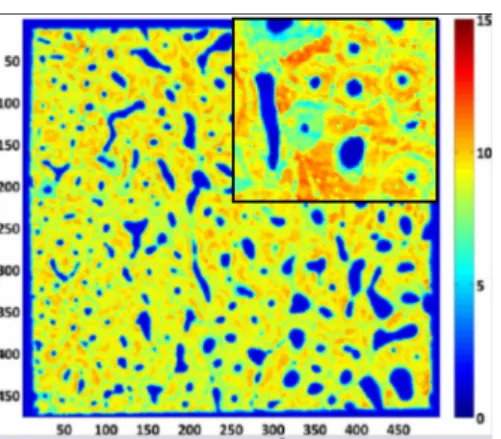 Fig. 1: Scanning acoustic microscopy (SAM) maps of acoustic impedance (MRayl) of human femoral cortical bone in a plane transverse to osteons