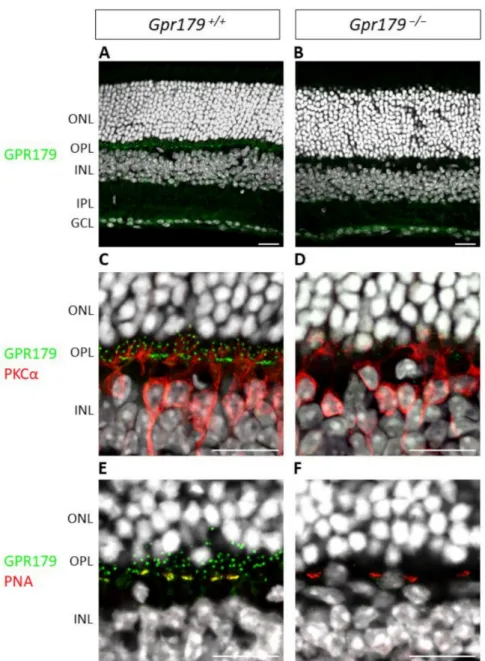 Figure 6. Validation of Gpr179 knock-out model. Representative confocal images of Gpr179 +/+ and Gpr179 −/− mouse retinal sections