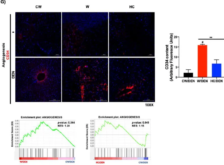 Figure 3. Tumors from lipid-enriched diets exhibit a profound change in gene expression favoring survival and prolifer- prolifer-ation signaling pathways and decreasing key tumor suppressor routes