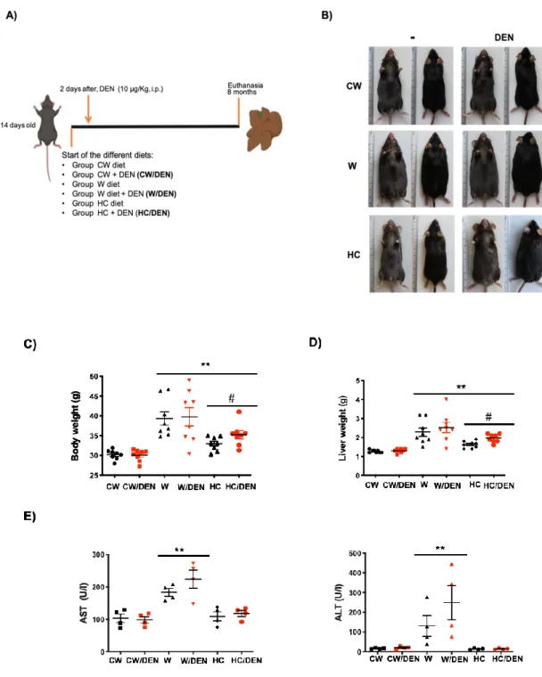 Figure 1. Lipid-enriched diets induce weight gain and liver damage. 14 days-old male mice were fed for 8 months with  western and high cholesterol diets as stated in Material and Methods
