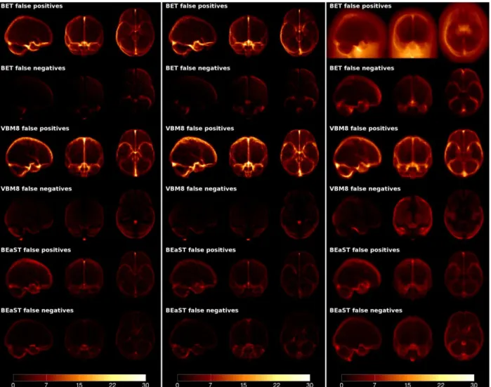 Fig. 6. False  positive and false  negative maps  for BET, VBM8, and BEaST on NIHPD,  ICBM  and  ADNI  data