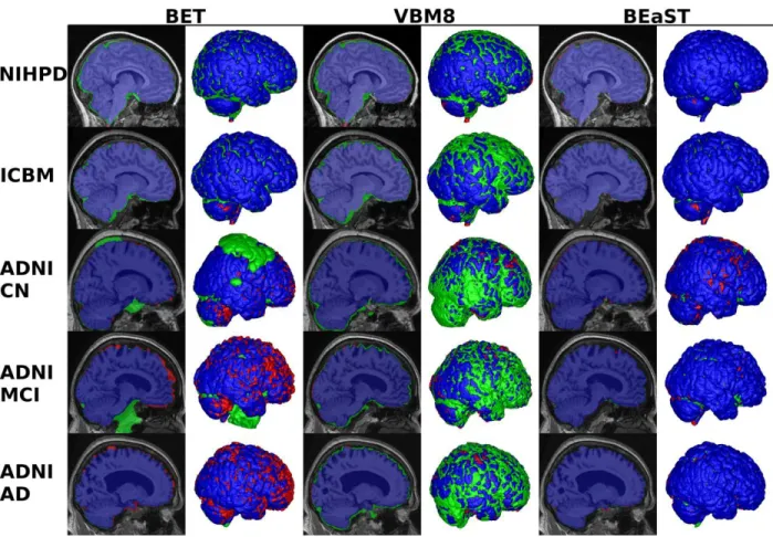 Fig. 7. Typical results using BET, VBM8 and BEaST on the five test groups. The figure shows  sagittal slices and 3D renderings of the segmentations