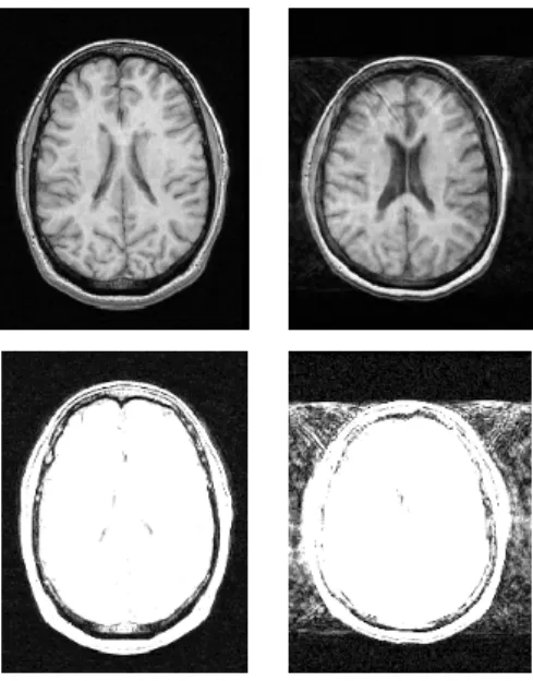 Fig. 6. Left: data without ghosting artefacts. Right: data with ghosting artefacts.