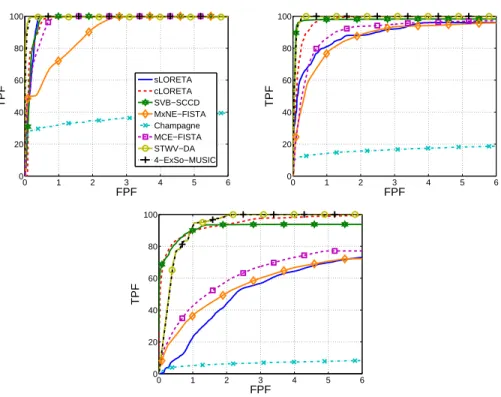 Figure 5: ROC curves obtained for the different source imaging methods for different sizes of the patch SupFr: (top left) 10 dipoles, (top right) 200 dipoles, (bottom) 400 dipoles