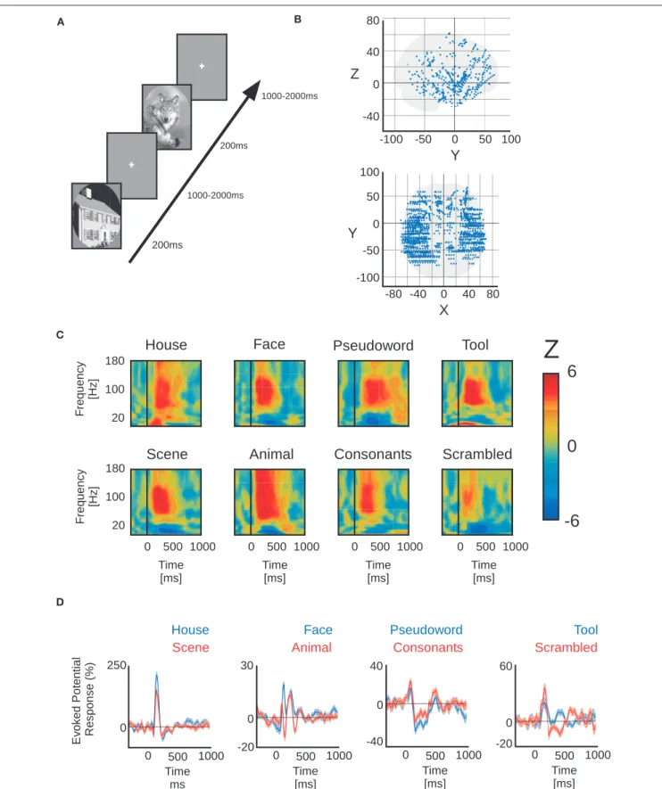 FiGuRE 1 | Paradigm, electrode implantation and neural responses. (A)  Example of the visual detection paradigm