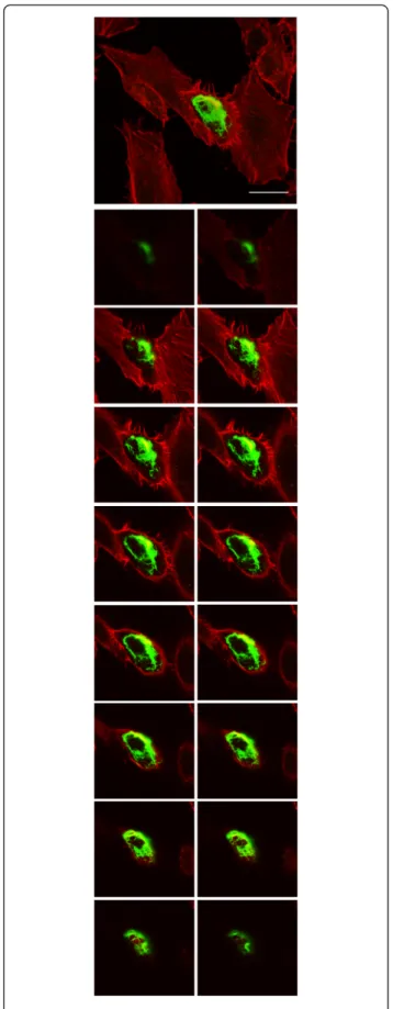 Figure 6 Ectopic expression of BtpA in HeLa cells induces filopodia. HeLa cells were transiently transfected with plasmids encoding GFP-BtpA