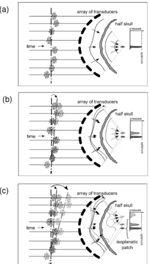 Figure 2. Concept of conventional steering, illustrated here for targets located in the focal plane of the   array   and   reached   using   beam-steering   from   a   set   of   pulse   signals   which   optimally   focus   on   the  geometrical center of