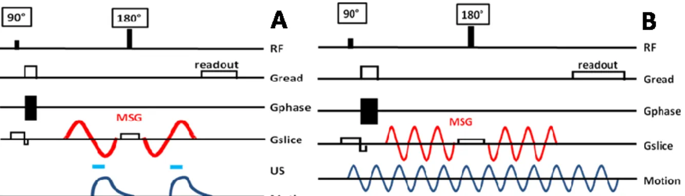 Figure  3:  The  radiation  force  induced  displacements  are  mapped  in  1  to 5  slices  oriented perpendicularly  to  the  US  beam