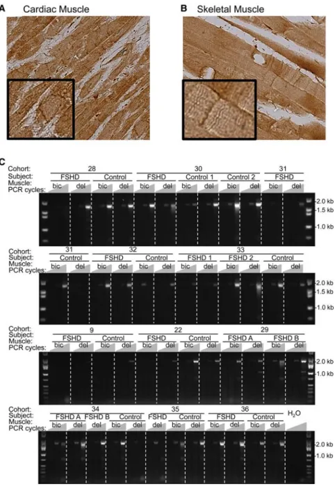 Figure 4. SORBS2 gene expression in skeletal muscle biopsies. Immunohistochemistry (IHC) staining of transversal biopsies of cardiac (A) and skeletal (B) muscle for the detection of SORBS2 (Epitomics, RB19714)
