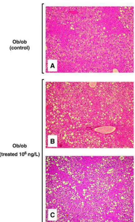 Figure 1. Hepatic steatosis in obese ob/ob mice treated or not with the cocktail containing 10 6  ng/l 524 