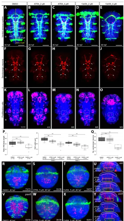 Fig. 6. Effects of exogenous RA on developing P. dumerilii . (A to Q) Effects of ATRA and 13cRA on larval development (48 to 80 hpf)