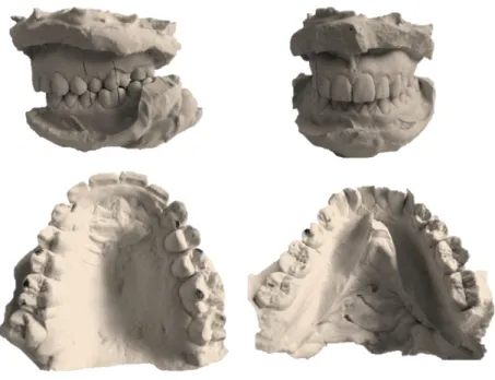 Figure 2. 7 : Moulages des arcades dentaires saines et identification des points d'occlusion en intercuspidie maximale 