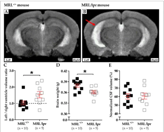 Figure 2. Cerebral abnormalities measured in MRL +/+  and MRL/lpr mice. Conventional mid-axial T2- T2-weighted MRI revealed a dilation of ventricles (red arrow) in 16-week-old female MRL/lpr mice (B)  as compared to the age-matched counterparts MRL +/+ mic