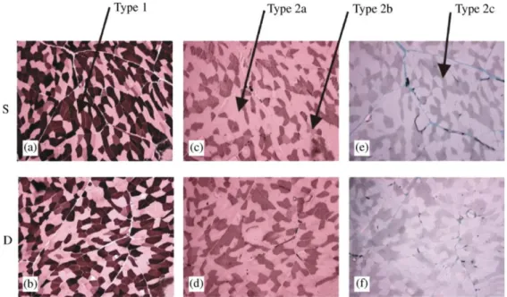 Figure 1.9: Histochemical appearance of different types of fiber in the Brachialis muscle [28].