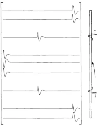 Figure 1.18: Muscle fiber current source density distribution represented by a spatio- spatio-temporal function [81].