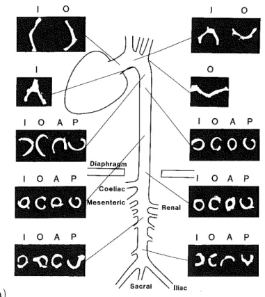 Figure 3.1 – (a) Photographs of the zero-stress configuration of aorta segments after internal stress release via open angle method from Liu and Fung [1988]