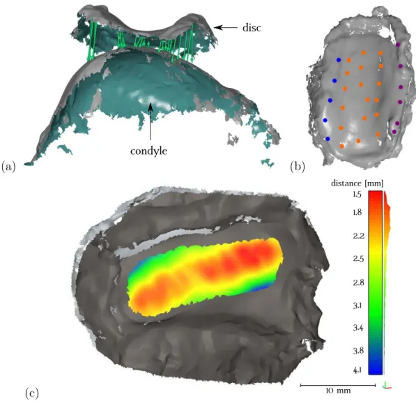 Figure 3.10 – (a) Obtained scans from condyle and disc surfaces as well as thickness measurements between them using GOM Inspect software