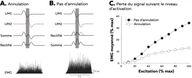 Figure 8 – Annulation du signal avec EMG de surface. A et B. Exemple d’annulation de l’amplitude sur le signal  EMG