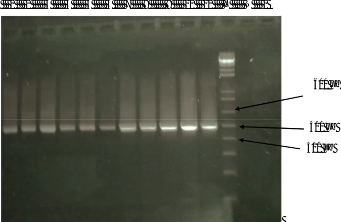 Figure  5 :  L’amplification  de  l’ADN  total  des  11  souches  productrices  de  BLSE