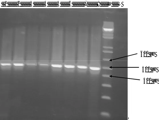 Figure  6 :  Analyse  sur  gel  d’agarose  du  produit  d’amplification  de  l’ADN  total des souches productrices de bêta-lactamases