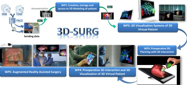 Figure 1: The 3D-Surg project contains five sequential workpackages (WP). They go from the initial data acquisition to the augmented reality setup in the operating room
