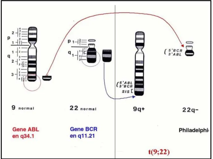 Figure 5 : Lieux de cassures classiques et mécanisme de formation du  gène BCR-ABL[Dr Franck Nicolini Groupe Fi(φ)-LMC] 
