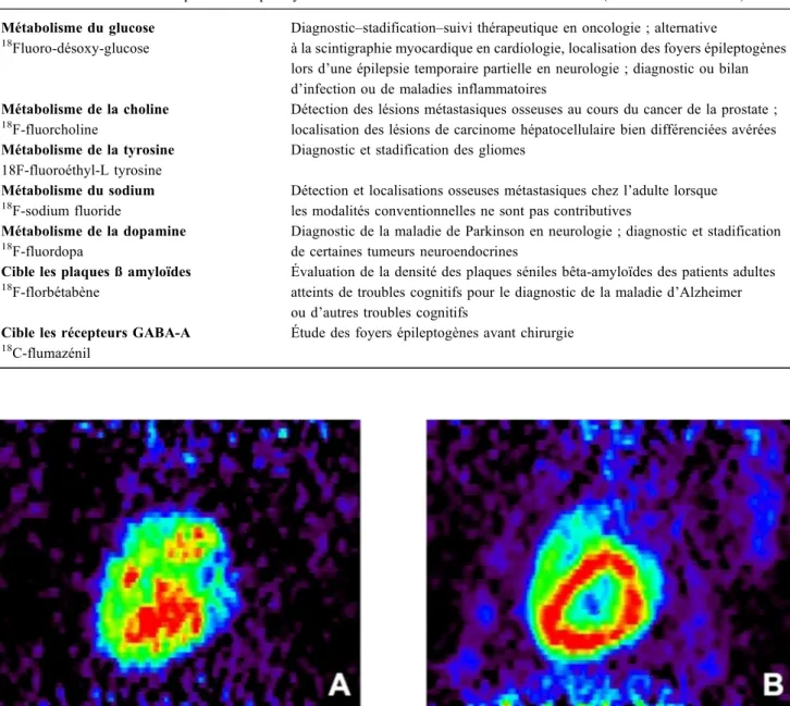 Fig. 3 Étude in vivo du stress oxydatif myocardique au cours du choc septique chez le cochon