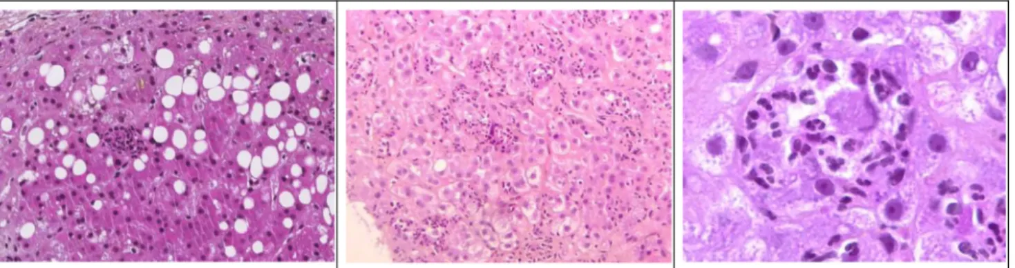 Fig. 1 Histologie hépatique en microscopie optique, coloration HES (hématoxyline éosine safran)