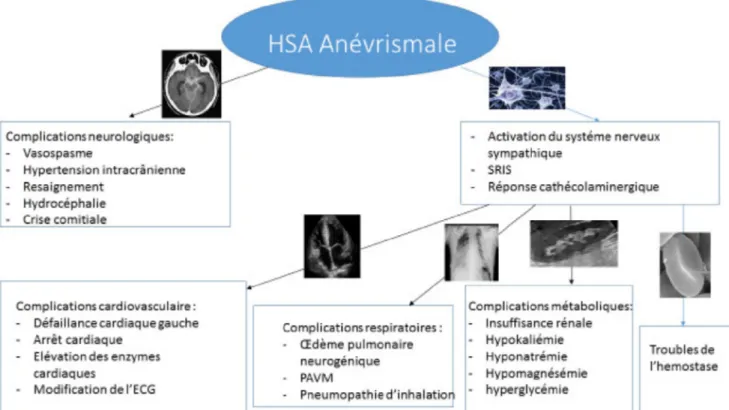Fig. 1 Complications extraneurologiques des HSA anévrismales