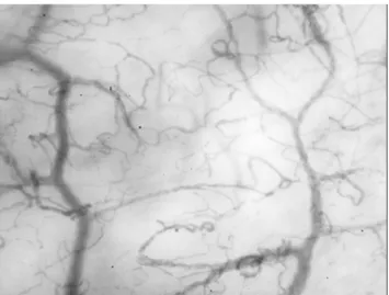 Fig. 1 Visualisation de la microcirculation sublinguale en utilisant la technologie IDF (Incidental Dark-Field)