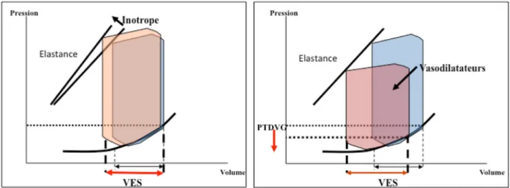Fig. 1 Boucles pression-volume et effets respectifs des inotropes et vasodilatateurs artériels sur le volume éjecté (VES), les pressions de remplissage (PTDVG) et la contractilité (représentée par la pente d ’ élastance)