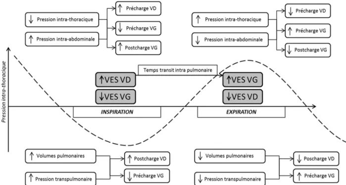 Fig. 1 Physiologie des interactions cardiopulmonaires en ventilation spontanée. VD : ventricule droit ; VG : ventricule gauche ; VES : volume d ’ éjection systolique