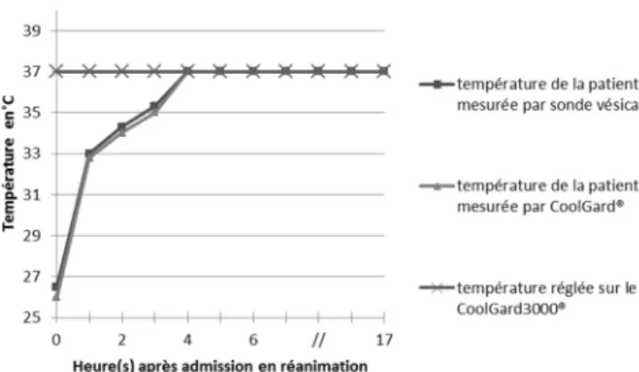 Fig. 1 Évolution de la température