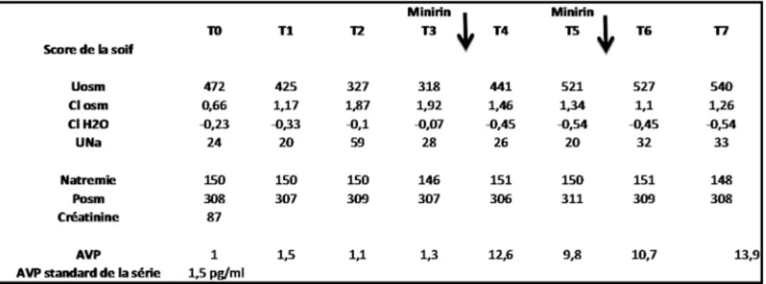 Fig. 2 Épreuve de restriction hydrique associée à l ’ administration sous-cutanée de dDAVP après les temps T3 et T5 (cas clinique n°9)