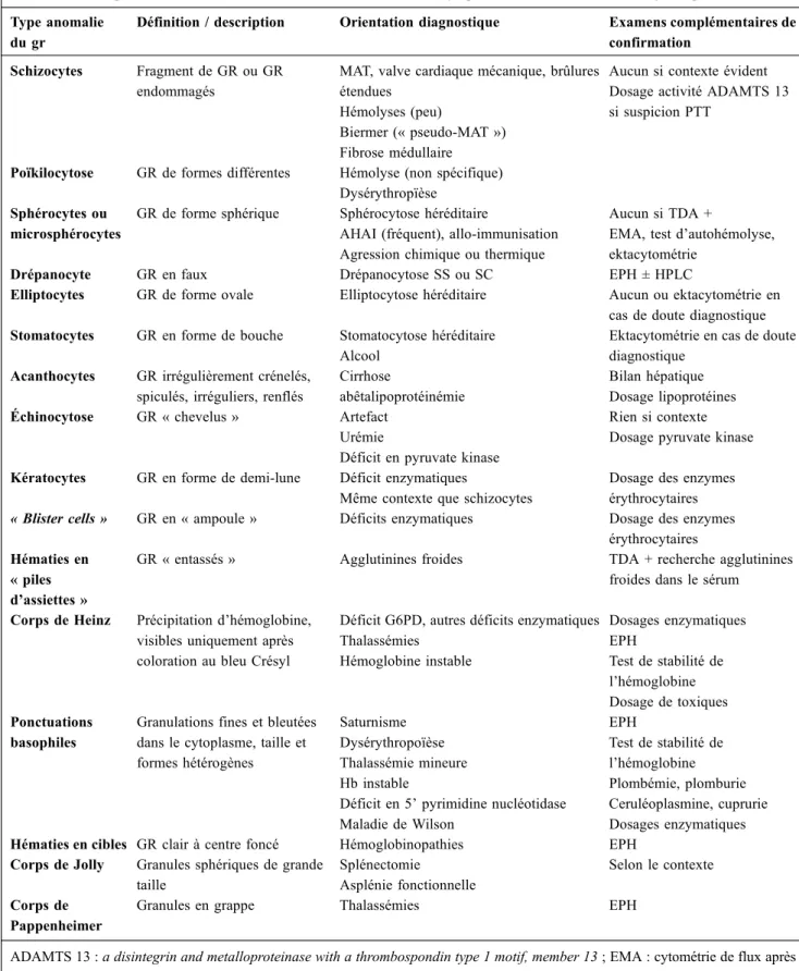 Tableau 7 Exemples d ’ anomalies du frottis au cours d ’ une anémie hémolytique de l ’ adulte et orientation diagnostique [53,54]