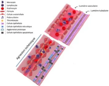 Fig. 1 Représentation schématique des lésions tissulaires micro- micro-vasculaire et tubulaires au décours de l ’ ischémie-reperfusion rénale