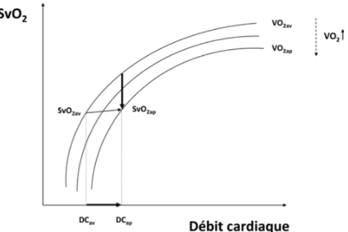 Fig. 1 Relation entre débit cardiaque et SvO 2 en fonction de la consommation d ’ oxygène (VO 2 )