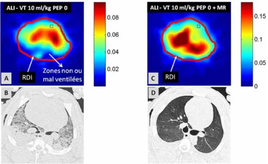 Fig. 6 Images de tomographie d ’ impédance électrique (TIE) fonctionnelles (TIE-f) (panneaux A et C) et de scanner thoracique (panneaux B et D) obtenues chez un porc soumis à une agression pulmonaire par lavage salé, ventilé à pression expiratoire positive