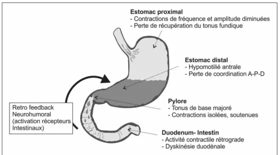 Fig. 1 Anomalies de motilité gastro-intestinale contribuant aux troubles de vidange gastrique du patient de réanimation.