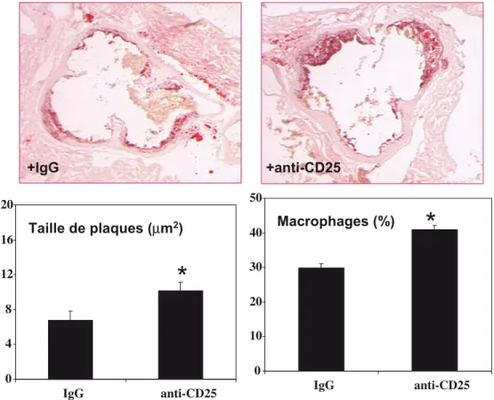 Fig. 3 À gauche : l ’ injection de lymphocytes Tr1 chez la souris apoE-/-, en présence de leur antigène spécifique (OVA), s ’ accompagne d ’ une diminution de la taille des plaques d ’ athérosclérose au niveau du sinus aortique