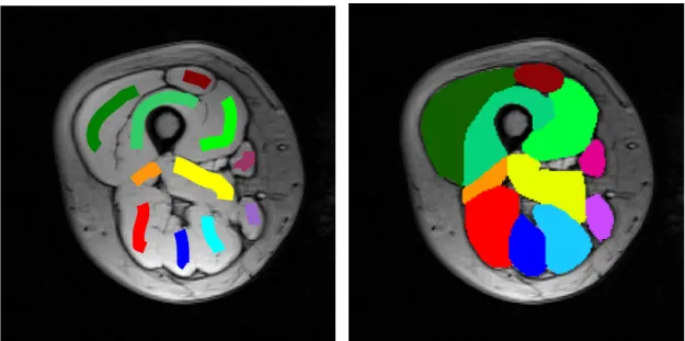 Figure 3.1.1 – (left) Axial cross-section of a right thigh with manually drawn seeds; (right) segmentation.