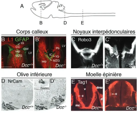 Figure 2. Phénotype des mutants Dcc -/-  chez la souris. (A) Schéma représentant le système  nerveux central d’une souris à P0 en vue sagittale et indiquant le niveau des différentes  coupes