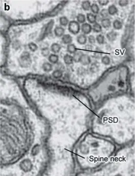 Figure 2. Morphologie d'une synapse  excitatrice observée en microscopie  électronique