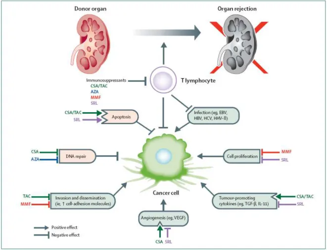 Figure 1. Mécanismes possibles pour la pathogénèse des néoplasies chez les patients transplantés (9)