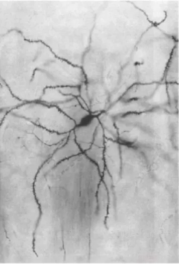 Figure 4 : Neurone épineux moyen du striatum  